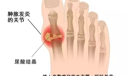 燥狂症能自愈吗-如何与燥狂症病人相处网 - 如何跟狂躁症病人说话,如何与燥狂症病人相处呢